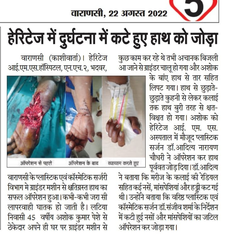 हेरिटेज में दुर्घटना में कटे हुए हाथ को जोड़ा